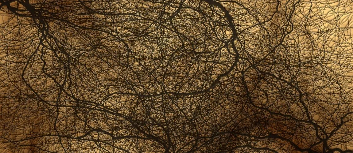 Abbildung eines dichten Netzwerks.