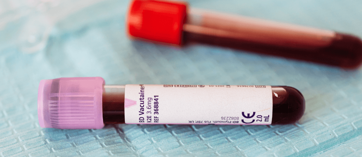 Zwei mit Blut gefüllte Röhrchen liegen auf einer Unterlage.