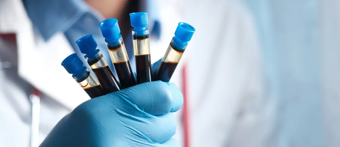 Eine Fachkraft hält mehrere Untersuchungsröhrchen mit Blut in der Hand.